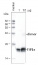 TIP1;1, TIP1;2 | tonoplast intrinistic protein 1-1, 1-2 (gamma)